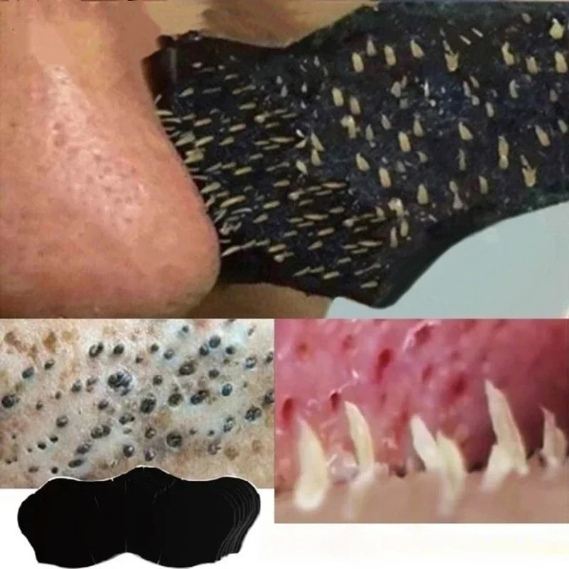 Unisex Blackhead Remove Mask N - Charcoal Pore Strip review and price