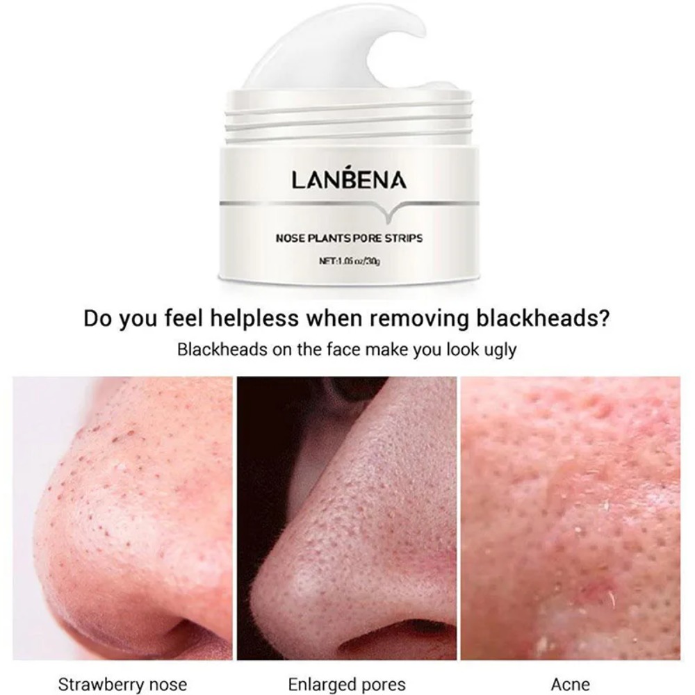 Nose Blackhead Remover Cream P - Charcoal Pore Strip review and price