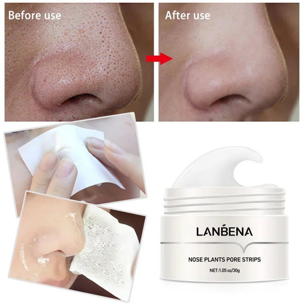 Nose Blackhead Remover Cream P - Charcoal Pore Strip review and price